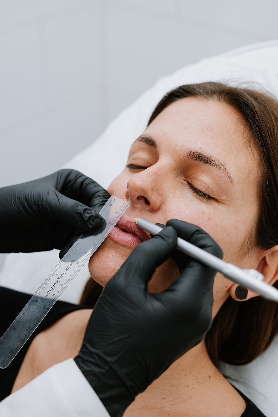 Lip Lift